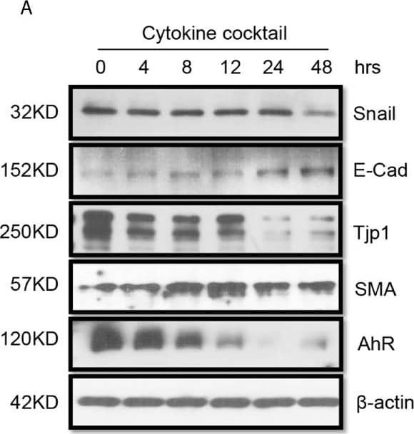 Western Blot: Tight Junction Protein 1 Antibody [NBP1-85047] - Western blot analysis of function protein expression on primary human renal cortical epithelial cells challenged with cytokines. Primary human renal tubular epithelial cells are challenged with cytokine cocktail (15nM IFN gamma , 6nM TNF alpha , & 3nM IL1 beta ). (A, B) Expression of Snail, E-Cad, TJP1, SMA. AhR, IDO, KMO, KY, MHCI & II. (C, D) Densitometric quantitation of protein in (A, B). All Western blots are representative of at least three independent experiments. *P < 0.05, ***P < 0.0001 versus to cells without treatment, analysis is multiple t-tests, pairwise comparison of individual time-point to control indicated same p-value. Image collected & cropped by CiteAb from the following publication (//pubmed.ncbi.nlm.nih.gov/34305900), licensed under a CC-BY license. Not internally tested by Novus Biologicals.