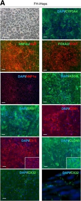 Immunocytochemistry/ Immunofluorescence: Tight Junction Protein 1 Antibody [NBP1-85047] - Differentiation of FH- & corr-FH-iPSCs into hepatocytes. a Representative pictures of cell morphology & immunostainings of the indicated markers at day 25 of differentiation. Scale bars: 50 μm. b Representative images of DCFA excretion at the biliary poles of corr-FH-iHeps. All images were taken with × 10 objective, z-stacks of xy sections of the cells were acquired with an epifluorescence microscope (Nikon Elipse) & analyzed with ImageJ software. Arrowheads indicate bile canaliculi Image collected & cropped by CiteAb from the following publication (//pubmed.ncbi.nlm.nih.gov/31358055), licensed under a CC-BY license. Not internally tested by Novus Biologicals.