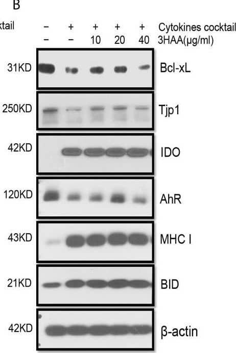 Western Blot: Tight Junction Protein 1 Antibody [NBP1-85047] - Protective role of 3HK & 3HAA in TEC stimulated with cytokines. Primary human renal TEC pre-incubated with different doses of 3HK or 3HAA overnight; the cells are challenged with the cytokine cocktail (15 nM IFN gamma , 6 nM TNF alpha , & 3 nM IL1 beta ) for 24 h; protein expression was assayed with Western blot: (A, B) 3HK & 3HAA cannot reverse IDO, MHC I, BID expression induced by cytokines. 3HK & 3HAA effectively restore Bcl-xL & Tjp1 expression. 3HAA shows its different function in up-regulation of AhR expression in TEC in inflammatory conditions. (C) Qualification of protein expression in TEC challenged with cytokine cocktail in the presence of 3HK. ***P < 0.0001 versus cell treated with Cyto. (D) Qualification of protein expression in TEC challenged with cytokine cocktail in the presence of 3HAA. ***P < 0.0001, ****P < 0.00001 versus cell treated with Cyto. Pairwise comparison of individual dose to control indicated same p-value. All Western blots are representative of three independent experiments; analysis is multiple one-way ANOVA. Image collected & cropped by CiteAb from the following publication (//pubmed.ncbi.nlm.nih.gov/34305900), licensed under a CC-BY license. Not internally tested by Novus Biologicals.