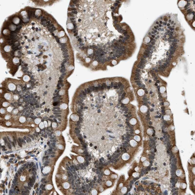 Staining of human Small intestine shows moderate cytoplasmic positivity in glandular cells.