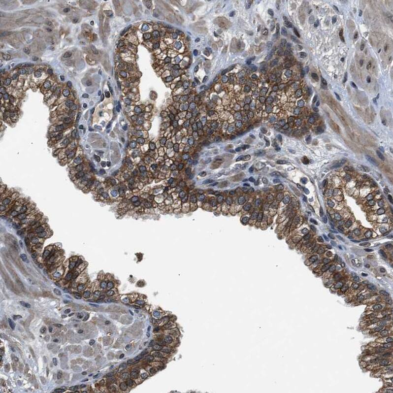 Staining of human Prostate shows moderate membranous positivity in glandular cells.