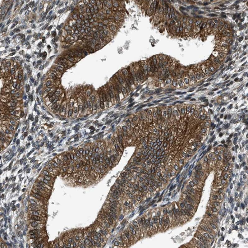 Staining of human Endometrium shows moderate membranous positivity in glandular cells.