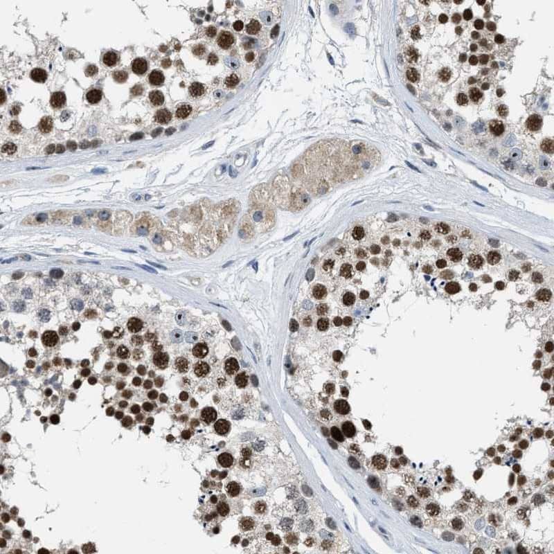 Immunohistochemistry-Paraffin ZNF783 Antibody - BSA Free