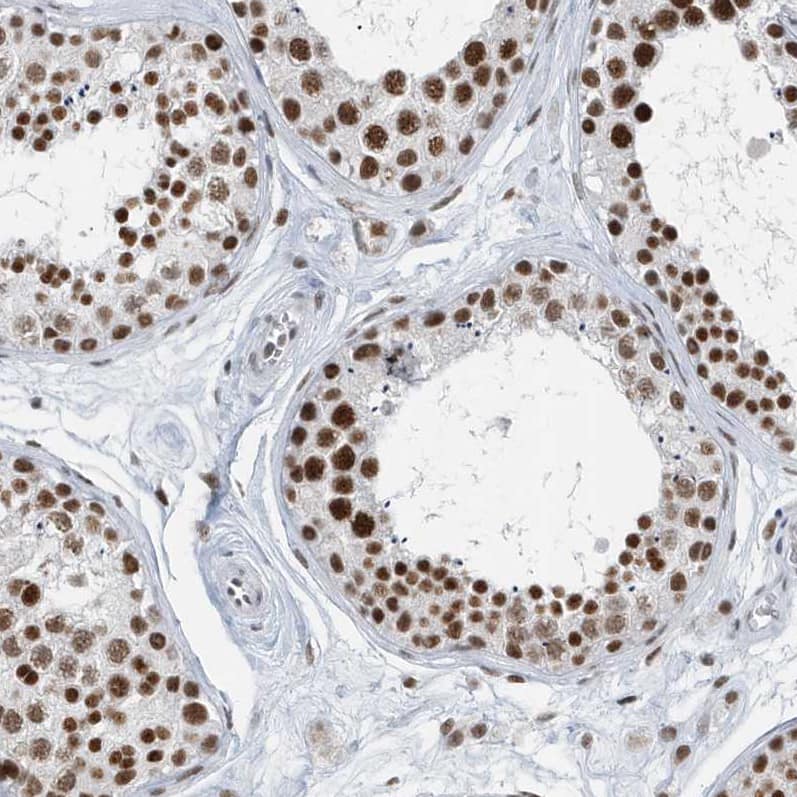 Immunohistochemistry-Paraffin FIP1L1 Antibody - BSA Free