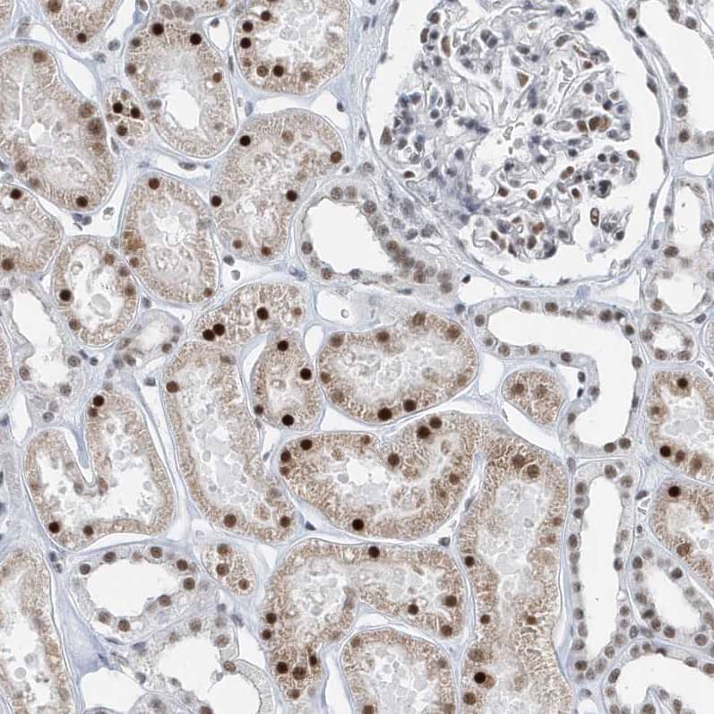Staining of human kidney shows strong nuclear positivity in cells in tubules.