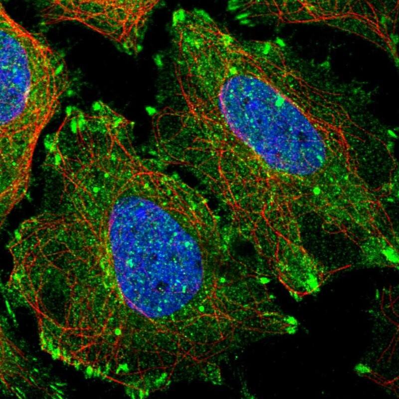 Staining of human cell line SiHa shows localization to plasma membrane, cytosol & focal adhesion sites.