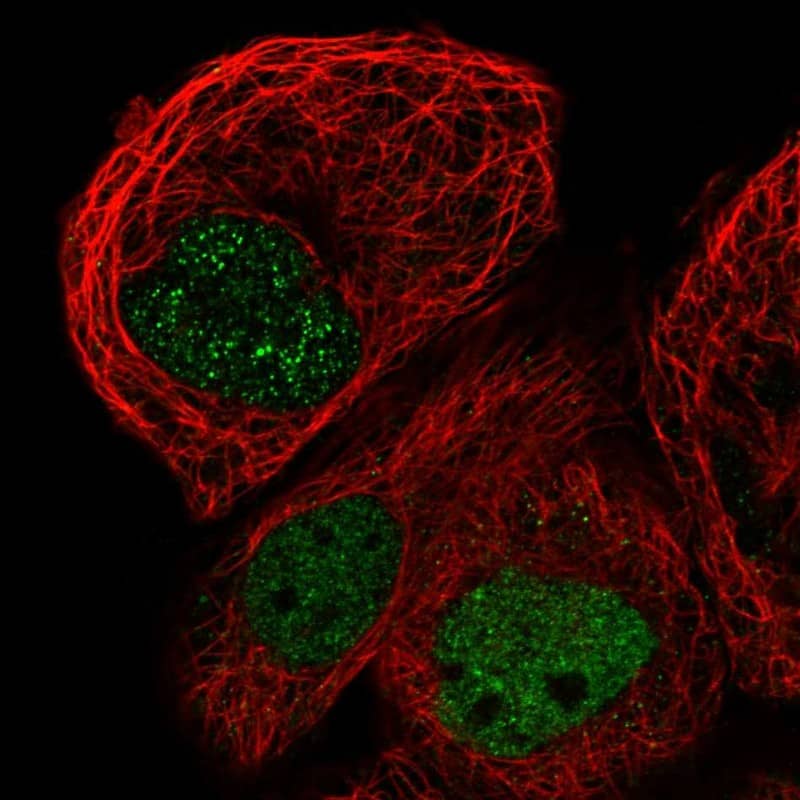 Staining of human cell line A-431 shows localization to nucleoplasm.