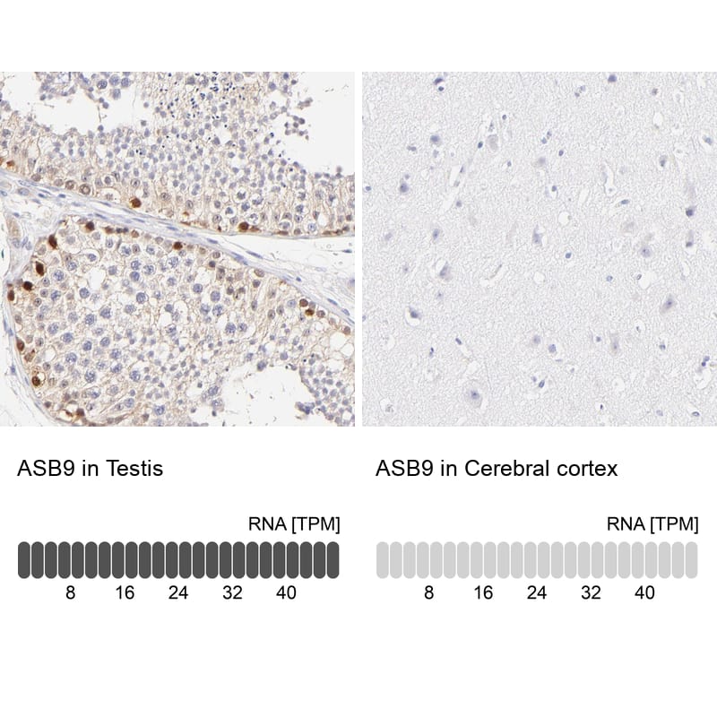 <b>Orthogonal Strategies Validation. </b>Analysis in human testis and cerebral cortex tissues. Corresponding RNA-seq data are presented for the same tissues.
