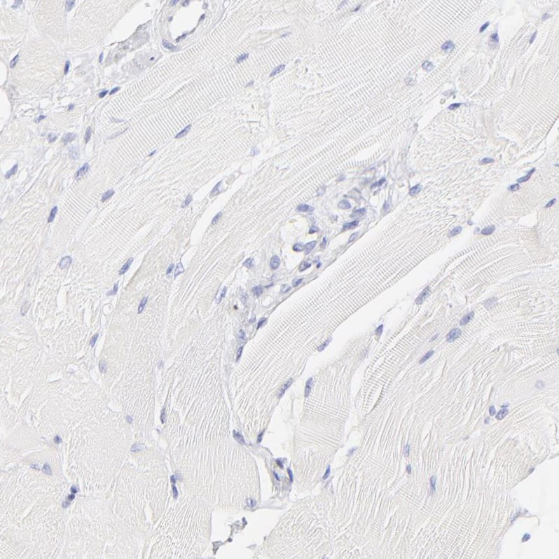 Staining of human skeletal muscle shows no positivity in myocytes as expected.