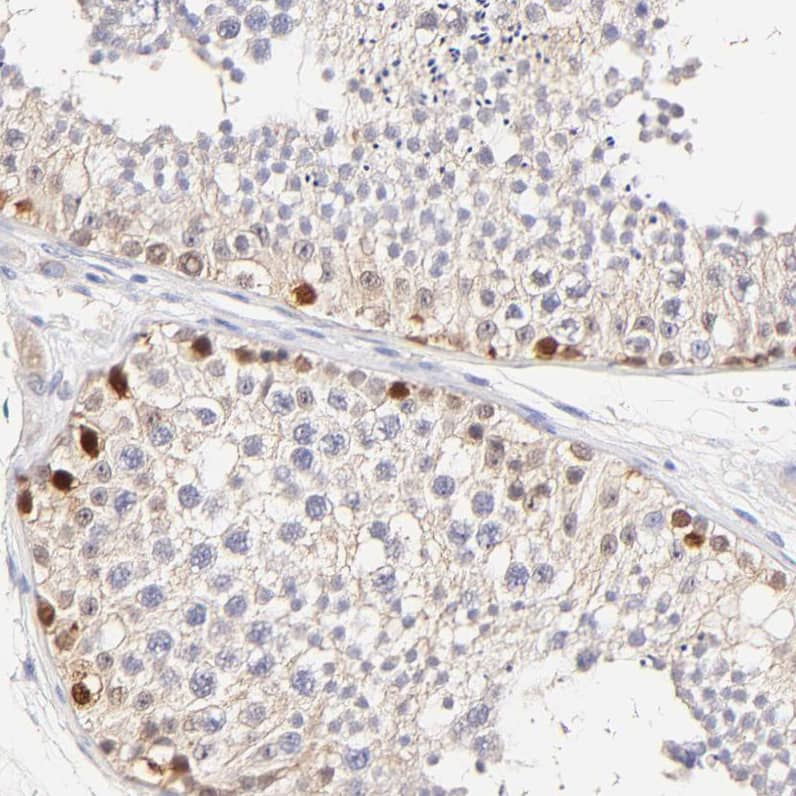 Staining of human testis shows moderate membranous positivity in cells in seminiferous ducts.