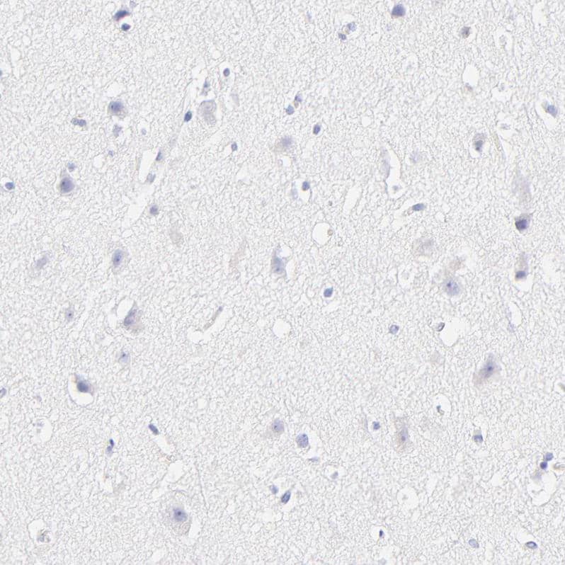 Staining of human cerebral cortex shows no positivity in neurons as expected.