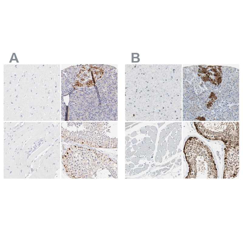 <b>Orthogonal Strategies Validation. </b>Staining of human cerebral cortex, pancreas, skeletal muscle and testis HPA003060 (A) shows similar protein distribution across tissues to independent antibody HPA003014 (B).