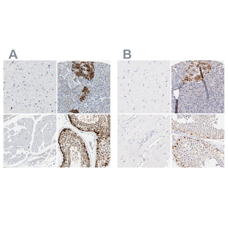 <b>Independent Antibodies Validation. </b>Staining of human cerebral cortex, pancreas, skeletal muscle and testis using NBP1-85082 (A) shows similar protein distribution across tissues to independent antibody NBP1-85081 (B).