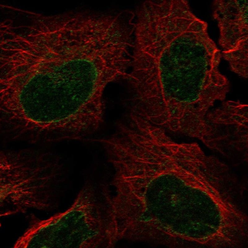 Staining of human cell line U-2 OS shows localization to nuclear membrane.