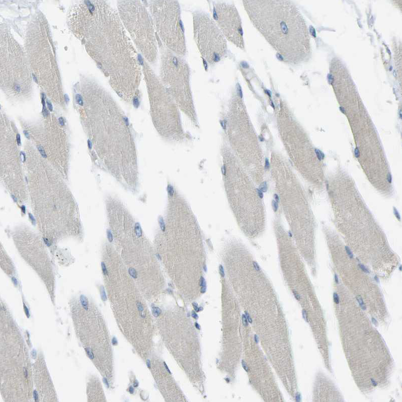 Immunohistochemistry-Paraffin RHBDD1 Antibody - BSA Free