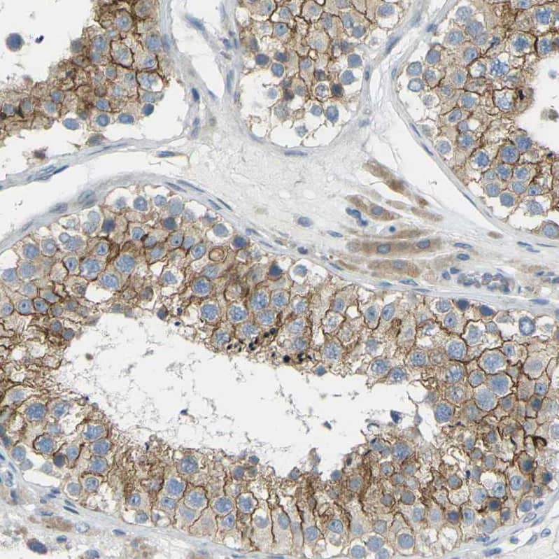 Immunohistochemistry-Paraffin RHBDD1 Antibody - BSA Free