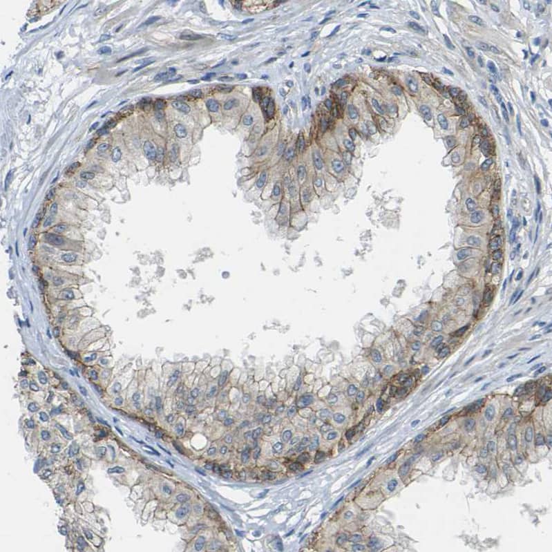 Staining of human prostate shows weak to moderate membranous positivity in glandular cells.