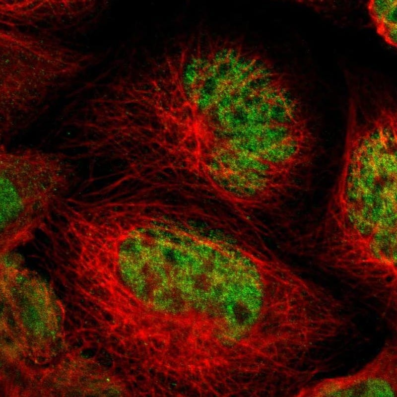 Staining of human cell line A-431 shows localization to nucleus.