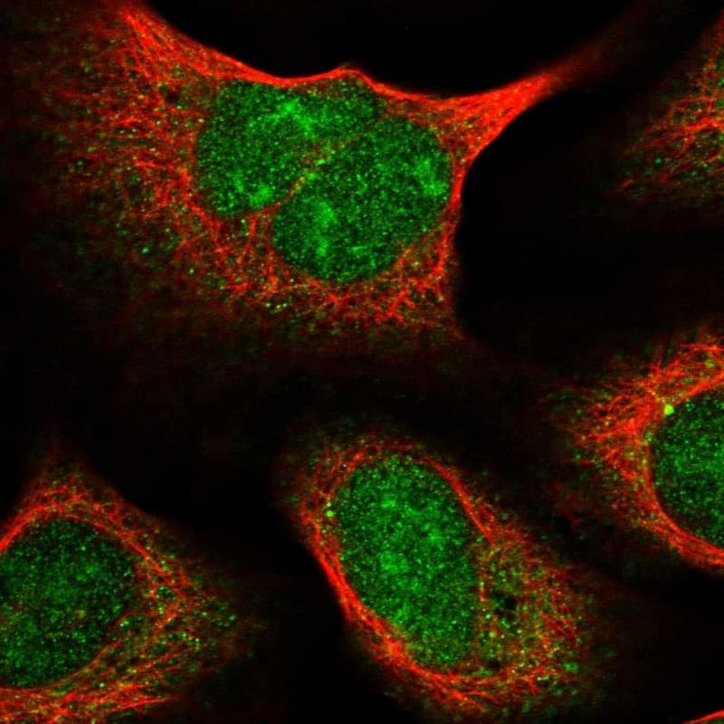 Staining of human cell line U-2 OS shows localization to nucleoli & cytosol.