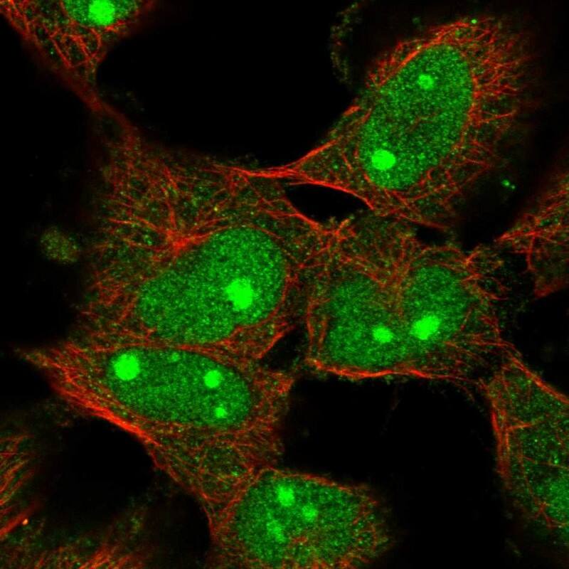 Staining of human cell line U-251 MG shows localization to nucleus & nucleoli.