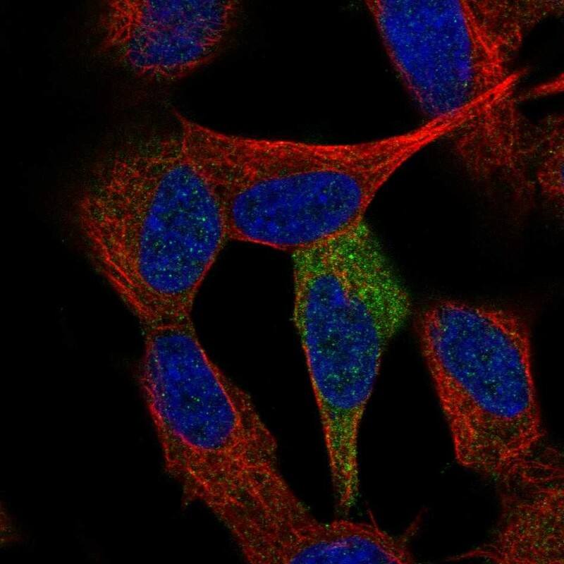 Staining of human cell line SH-SY5Y shows localization to cytosol.