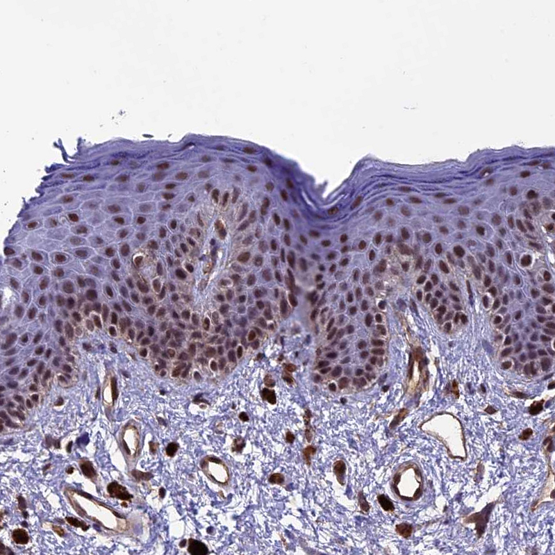 Immunohistochemistry-Paraffin NIPBL Antibody - BSA Free