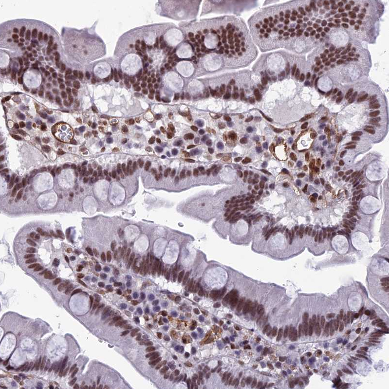Immunohistochemistry-Paraffin NIPBL Antibody - BSA Free
