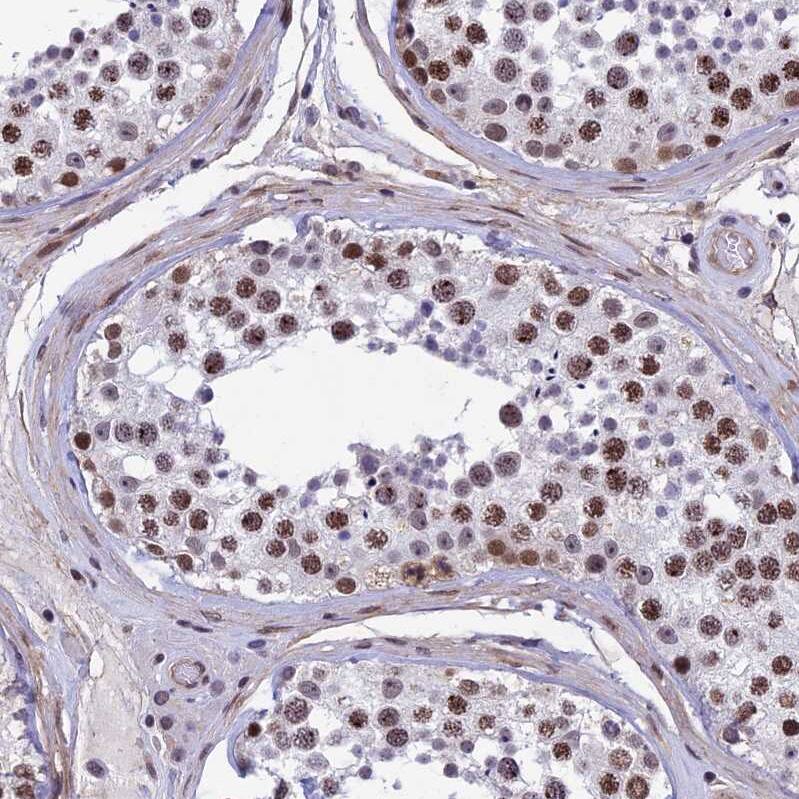Staining of human testis shows strong nuclear positivity in cells in seminiferous ducts.