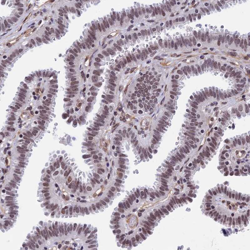Staining of human fallopian tube shows moderate nuclear positivity in glandular cells.