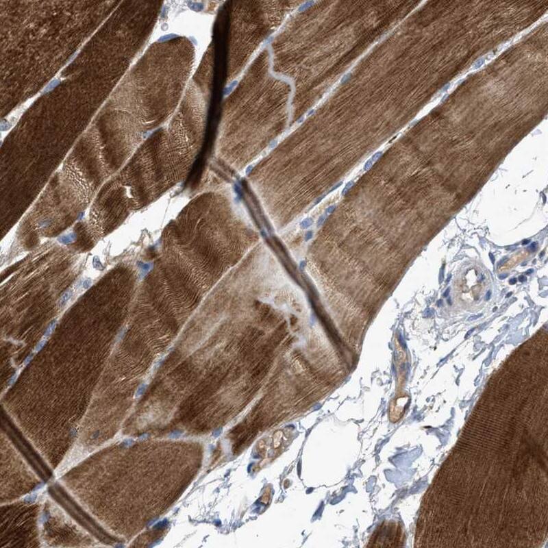 Staining of human skeletal muscle shows cytoplasmic positivity in myocytes.