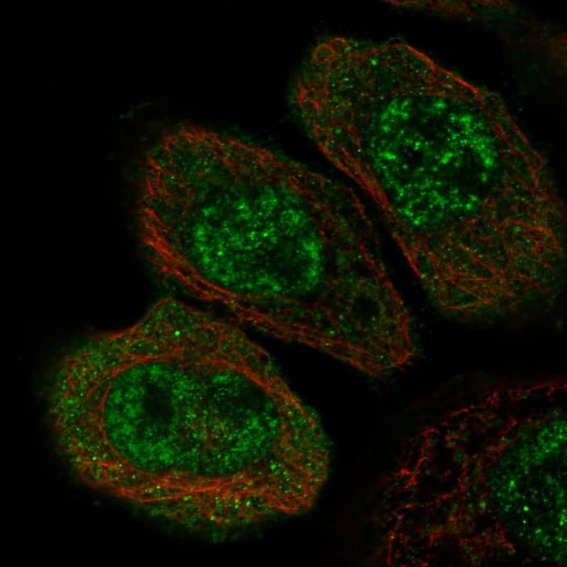 Staining of human cell line A-431 shows localization to nuclear speckles & cytosol.