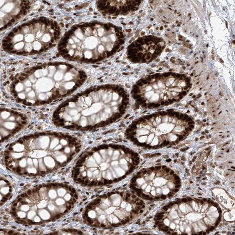 Staining of human rectum shows strong nuclear positivity in glandular cells.