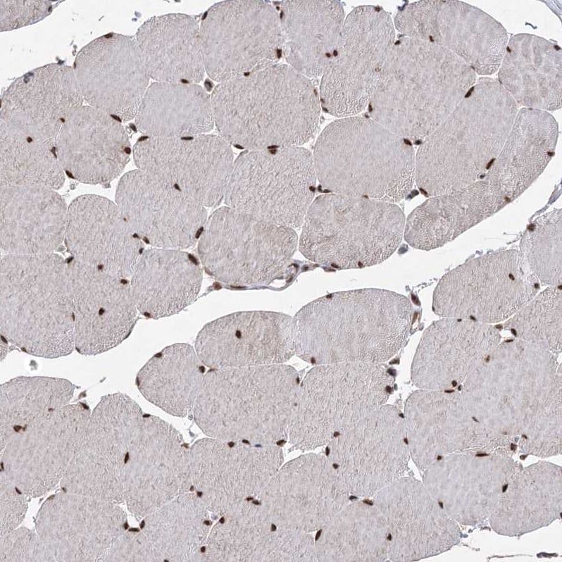 Staining of human skeletal muscle shows strong nuclear positivity in myocytes.