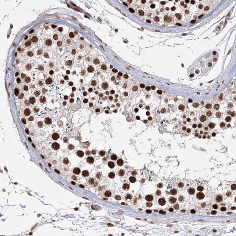 Staining of human testis shows strong nuclear positivity in cells in seminiferous ducts.