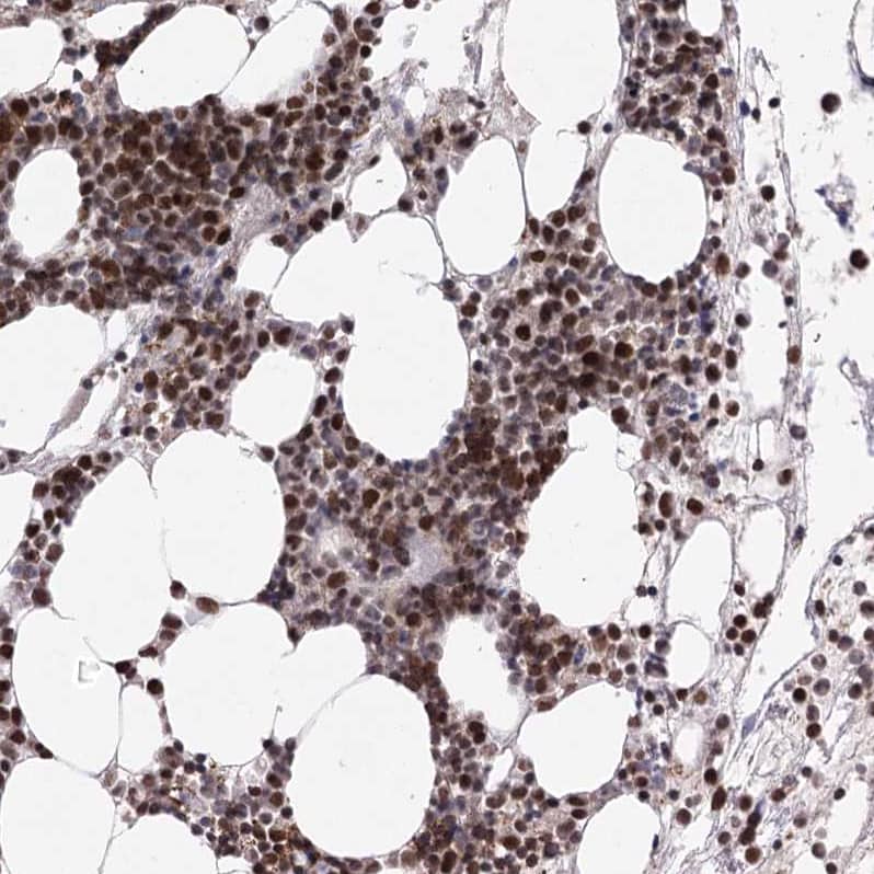 Staining of human bone marrow shows strong nuclear positivity in hematopoietic cells.