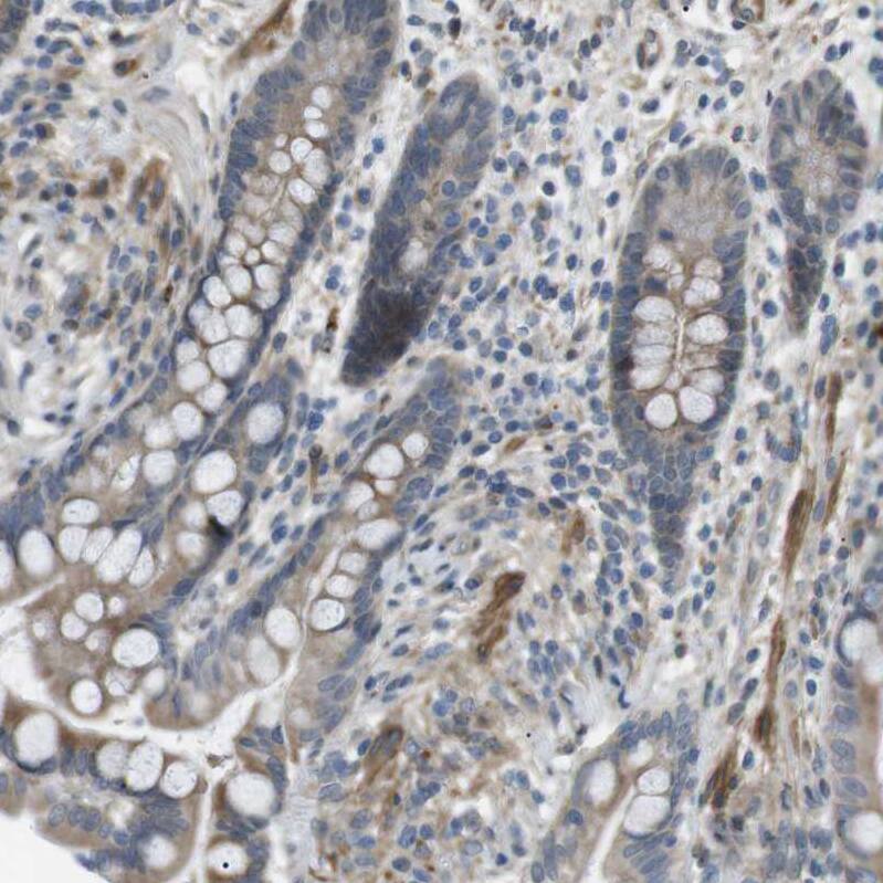 Immunohistochemical staining of human colon shows moderate cytoplasmic positivity in glandular cells.