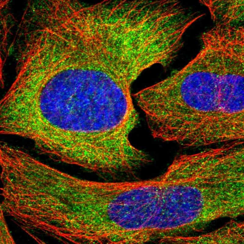 Staining of human cell line U-2 OS shows localization to cytosol.
