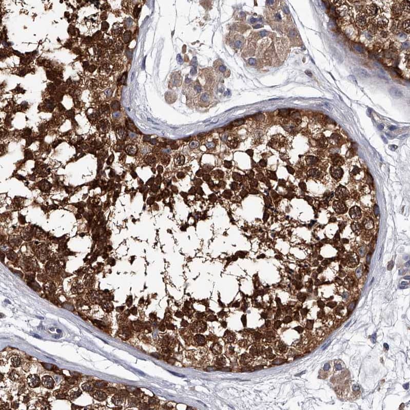 Staining of human testis shows strong cytoplasmic positivity in cells in seminiferous ducts.