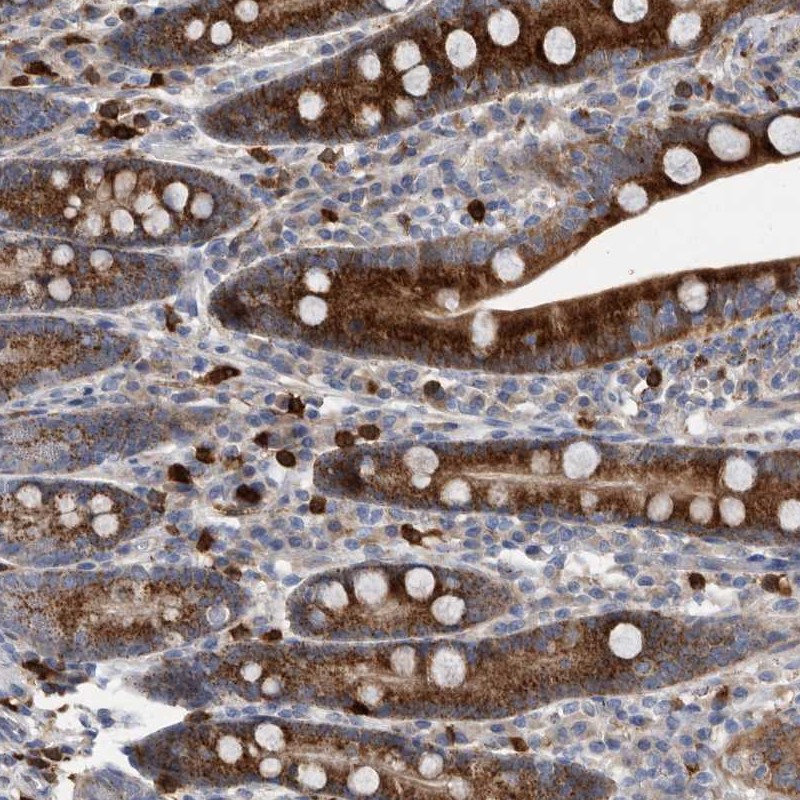Immunohistochemistry-Paraffin CRISPLD2 Antibody - BSA Free