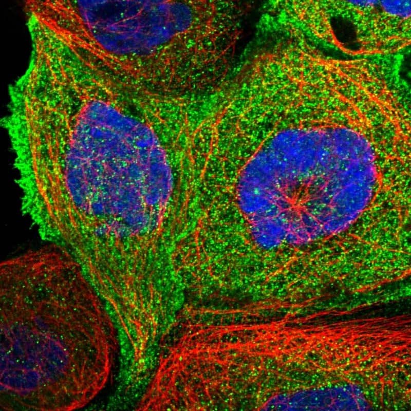 Staining of human cell line A-431 shows localization to plasma membrane & cytosol.