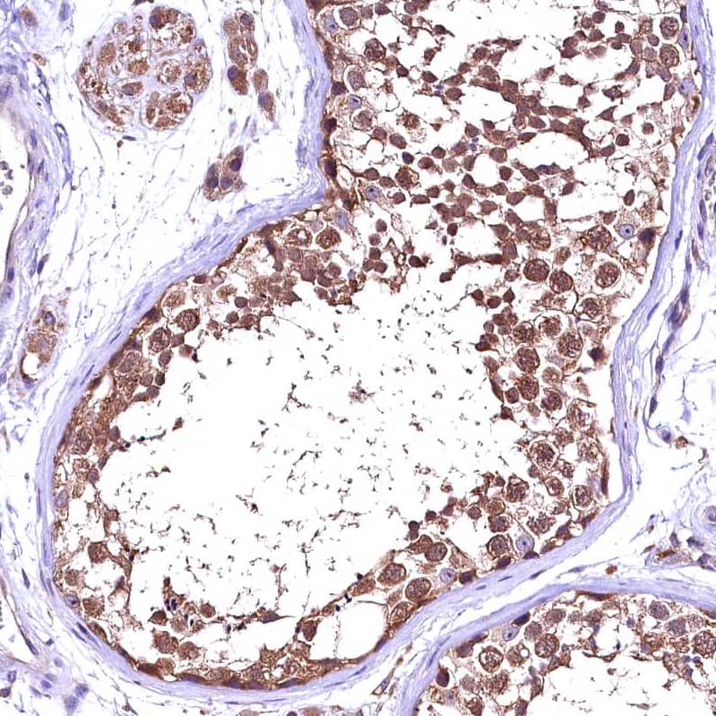 Staining of human testis shows strong cytoplasmic positivity in cells in seminiferous ducts.