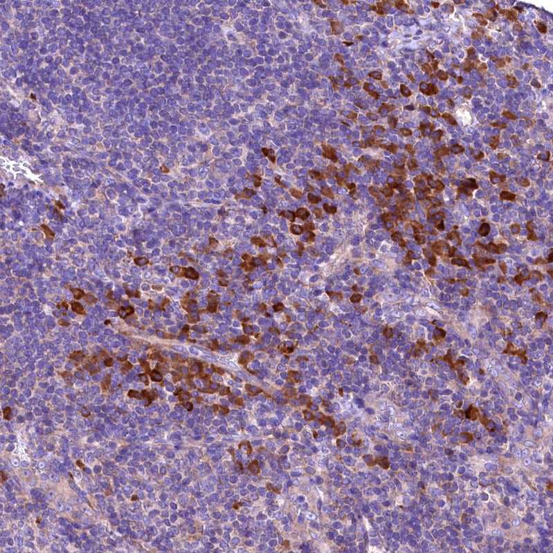 Staining of human tonsil shows strong cytoplasmic positivity in non-germinal center cells.
