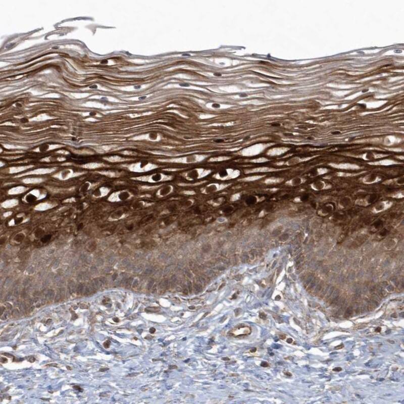 Staining of human cervix, uterine shows strong cytoplasmic and nuclear positivity in squamous epithelial cells.
