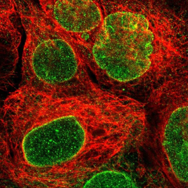 Staining of human cell line A-431 shows localization to nuclear membrane.