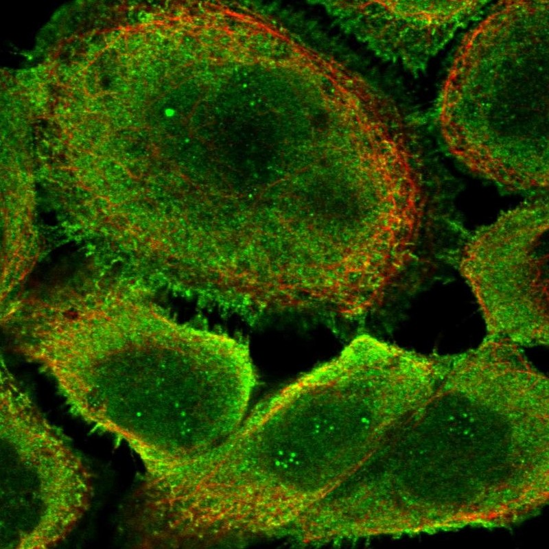 Staining of human cell line A-431 shows positivity in nucleoli, plasma membrane & cytoplasm.