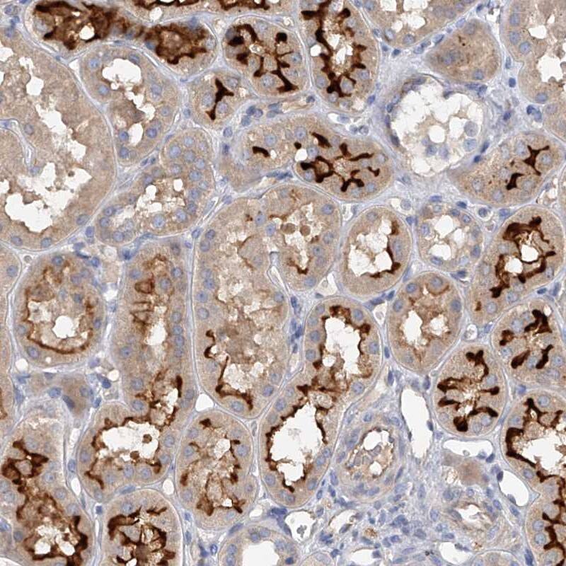 Staining of human kidney shows strong luminal membrane positivity in cells in tubules.