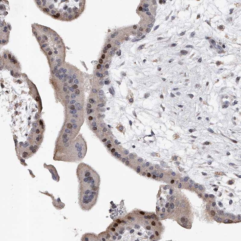 Staining of human placenta shows strong nuclear positivity in trophoblastic cells.