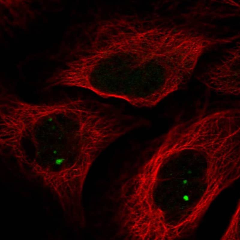 Staining of human cell line U-2 OS shows localization to nuclear bodies.
