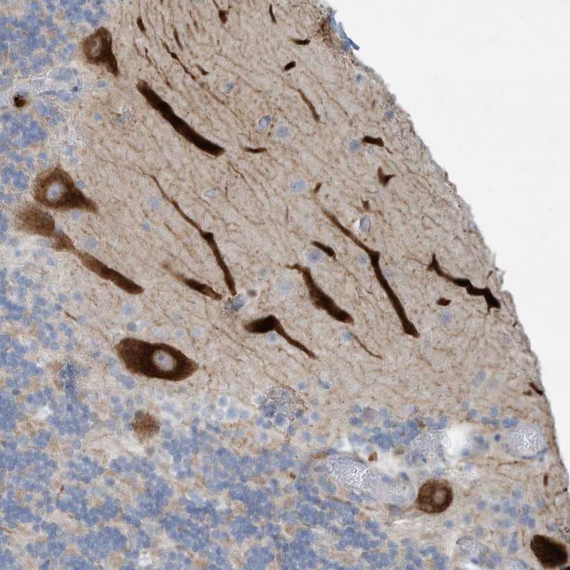 Staining of human cerebellum shows strong cytoplasmic positivity in Purkinje cells.