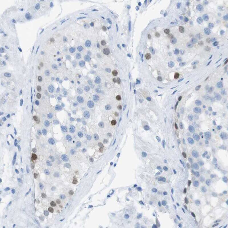 Staining of human testis shows weak nuclear positivity in cells in seminiferous ducts.